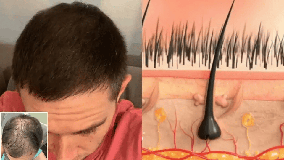 Herbal Hair Soap - Shampoo Bar (Amla, Reetha & Shikakai) | PACK OF 3